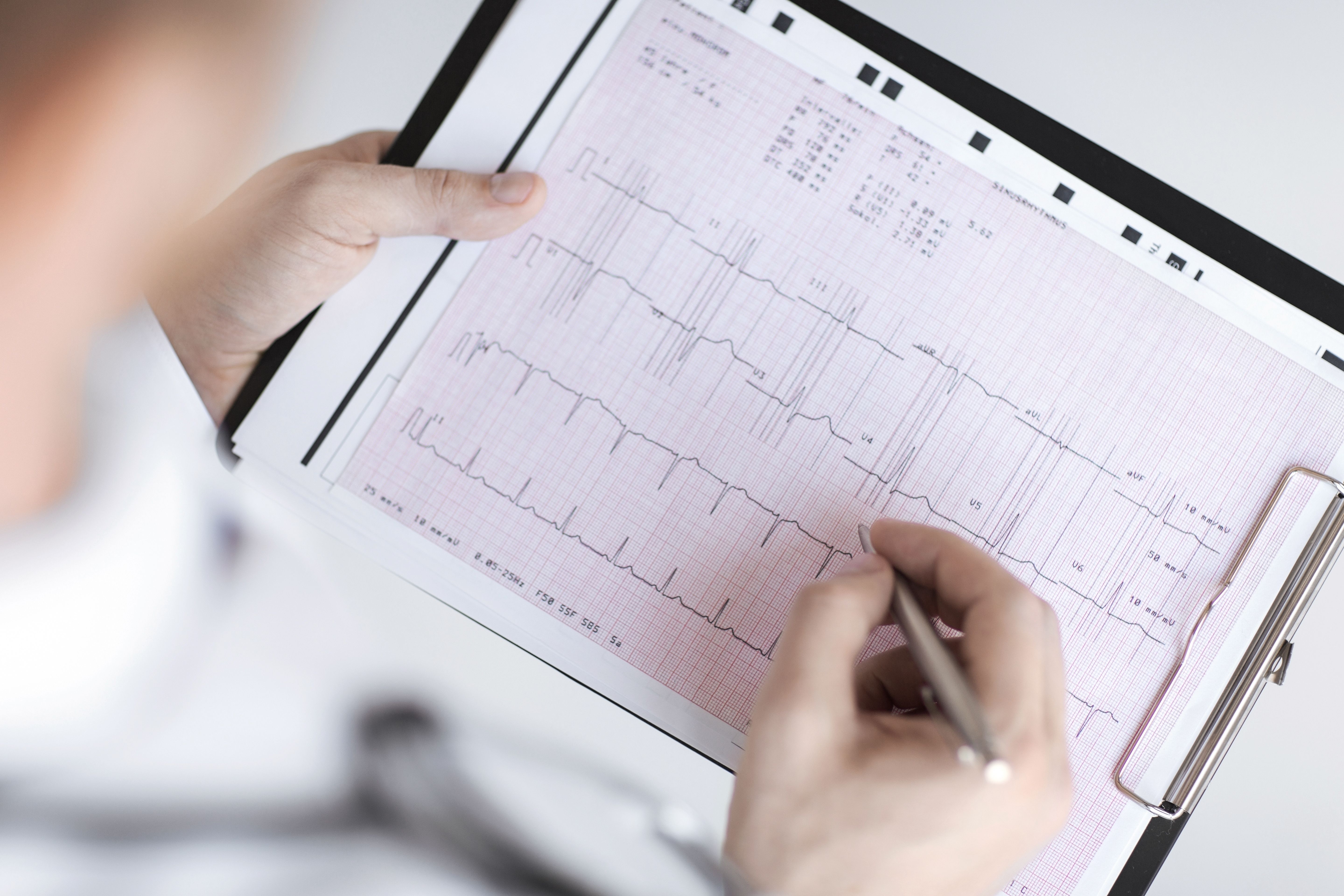 Hand writing on heart test results