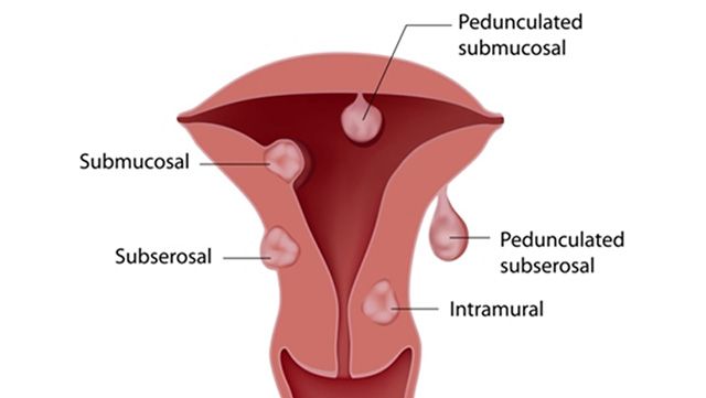 Illustration of the vaginal tissues