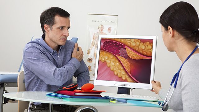 Doctor and patient viewing illustration of coronary heart disease