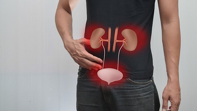 Man with hand placed near sore kidneys / bladder