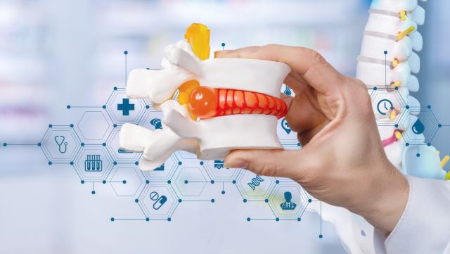 Hand holding plastic model of vertebrae