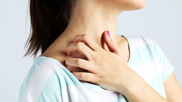 Woman scratching at eczema on her neck
