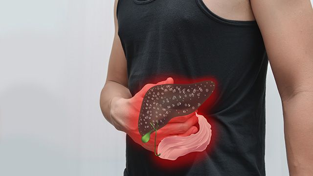 Illustration showing fatty liver disease in the body