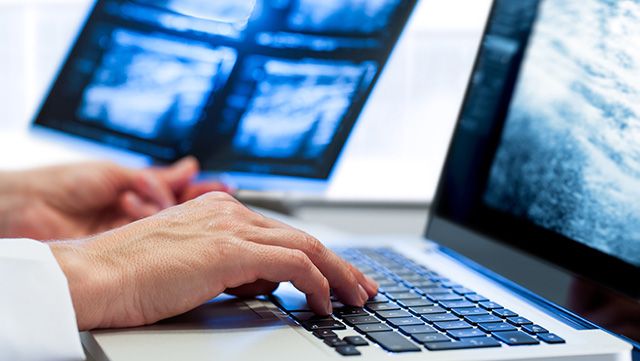 Hands typing on a keyboard and holding imaging results