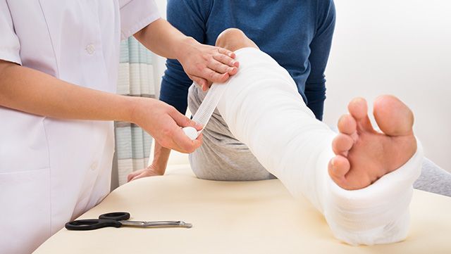 Patient receiving a cast on the lower right leg