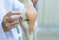 Doctor holding a 3D model of the knee joint