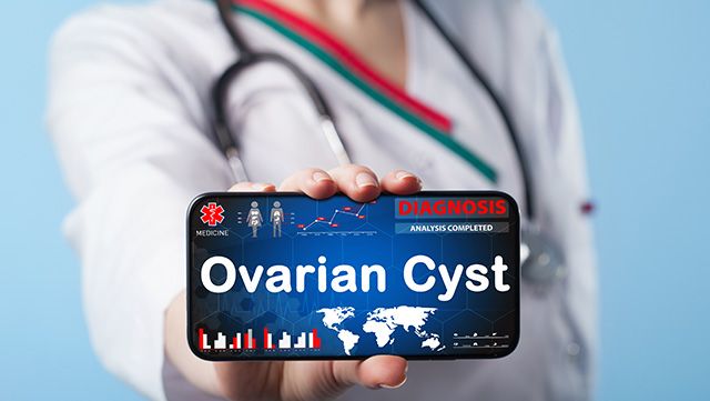 Doctor holding a smartphone showing the diagnosis "Ovarian Cyst"