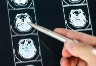 Hand using a pen to point at radiology images