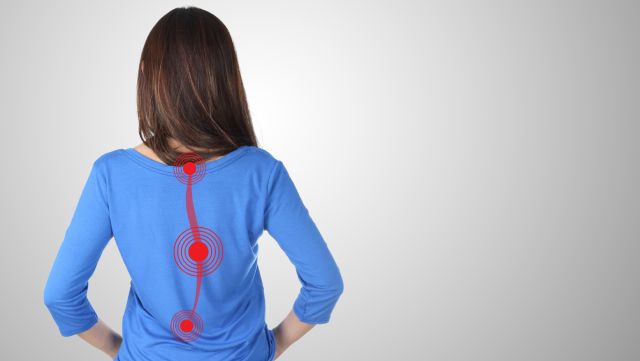 Back view of a woman with a superimposed illustration showing scoliosis