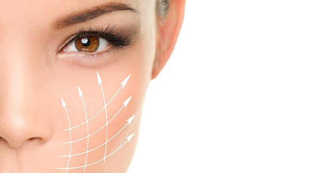 Woman's cheek with lines showing medical aesthetic procedure